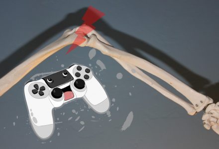 Armknochen, Controller und Blitz am Ellbogen